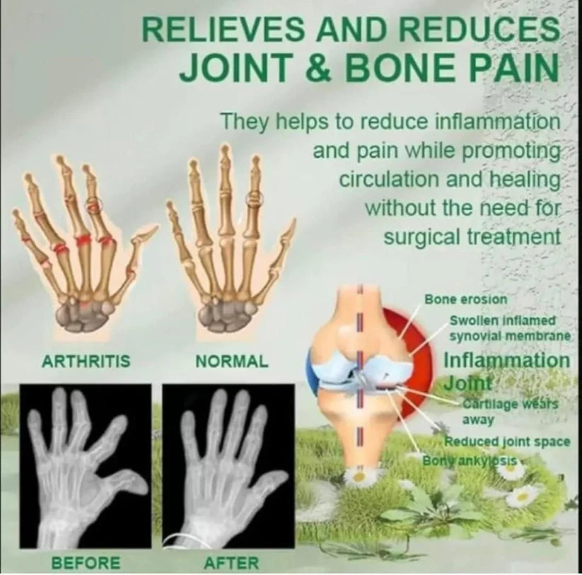 India's No.1 Bee Venom Pain Relief Cream (Buy 1 Get 3 Free)